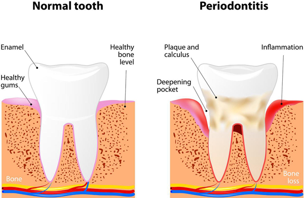 Periodontics